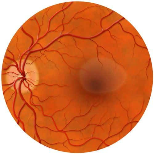 Central Serous Chorioretinopathy: Current Treatment