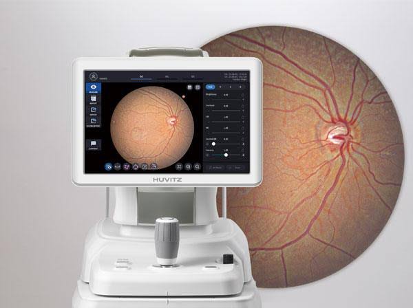 FUNDUS Photo by Huvitz, South Korea