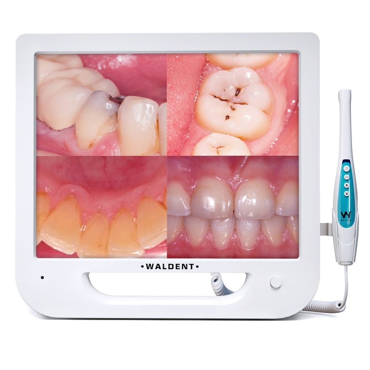 Intra Oral Camera by Waldent, India