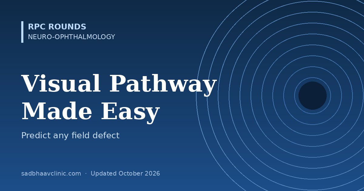 Visual Pathway and Field Defects Made Easy: Five Rules